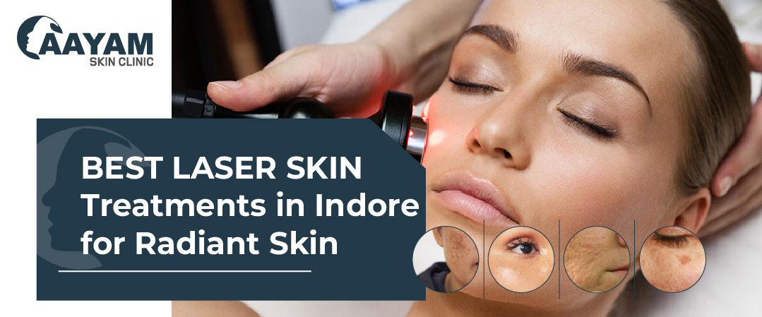 Laser Skin Treatment by Dr. Abhilasha Best Laser Skin Treatments in Indore