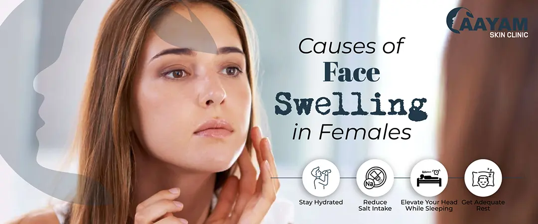 Face Swelling in Females