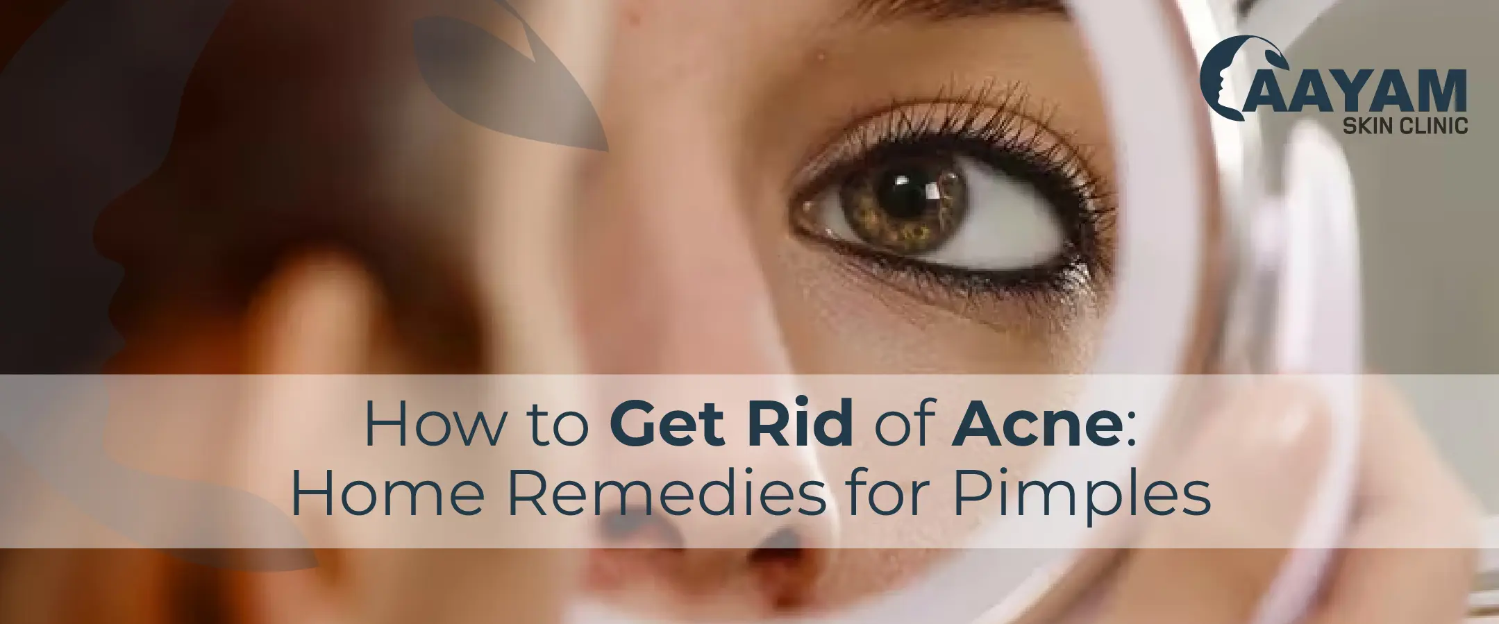 How to Get Rid of Acne: Top Home Remedies for Pimples