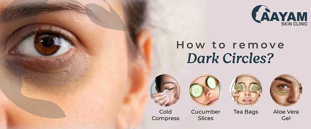 How to remove dark circles? 