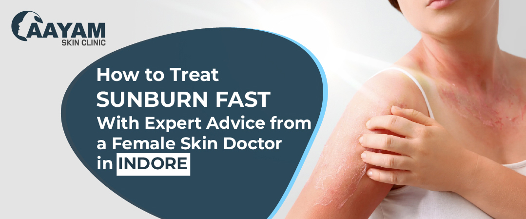 Woman with sunburned skin seeking fast relief – Aayam Skin Clinic