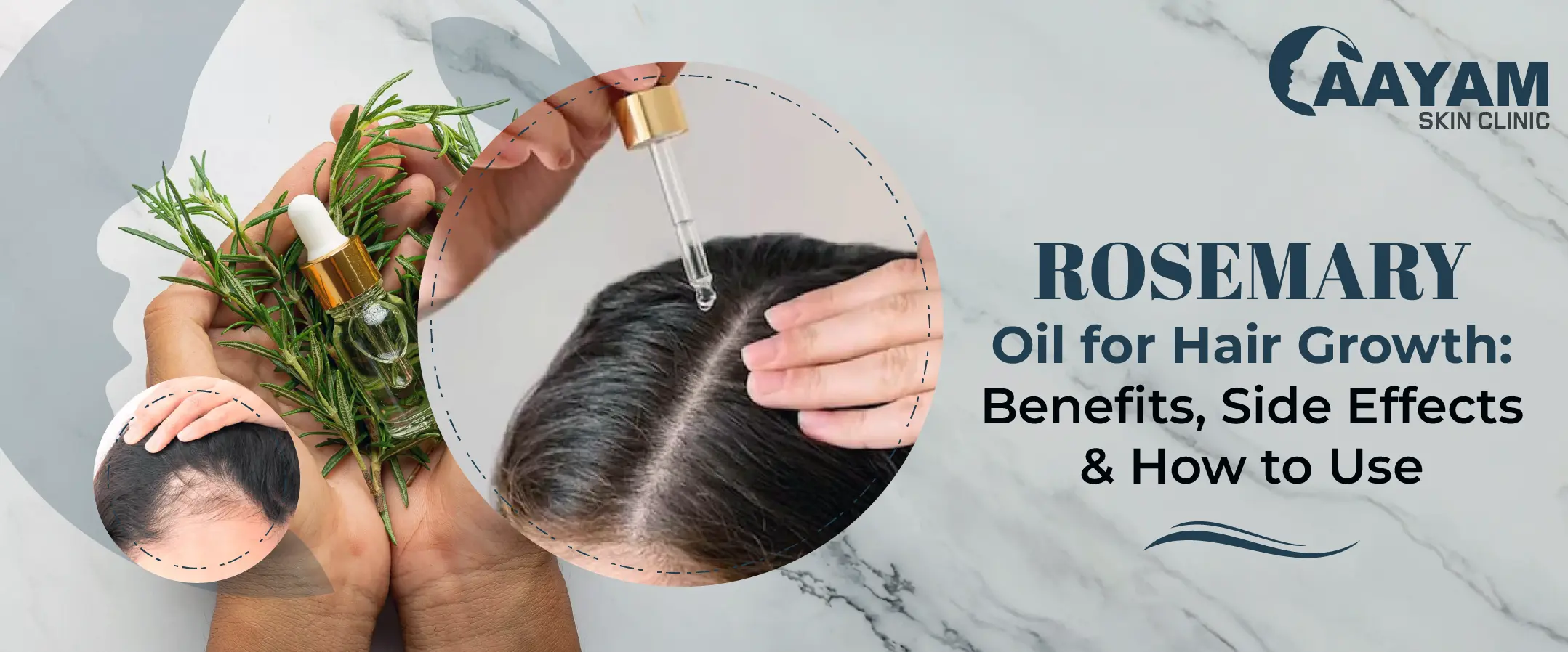 Rosemary Oil for Hair Growth