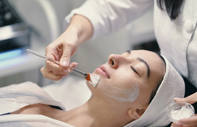 Chemical Peels