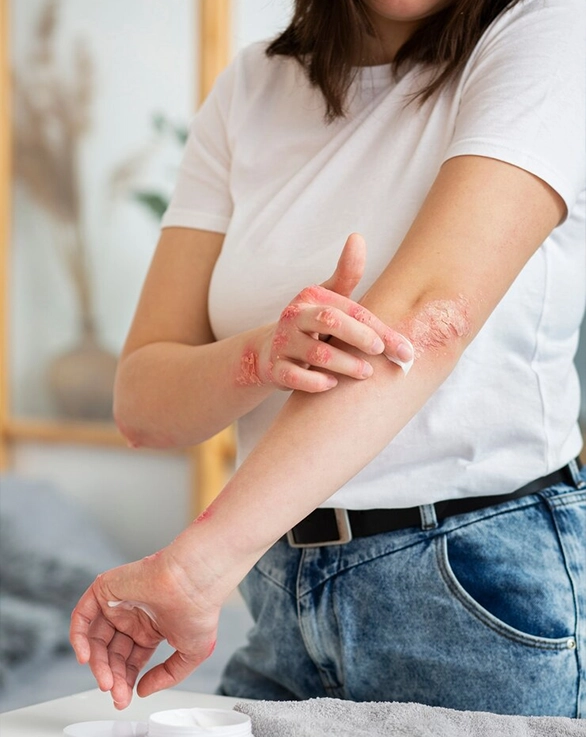 Treatment Process