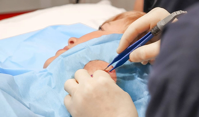 Nail Surgery