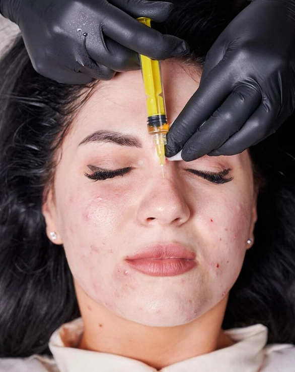 Treatment Process