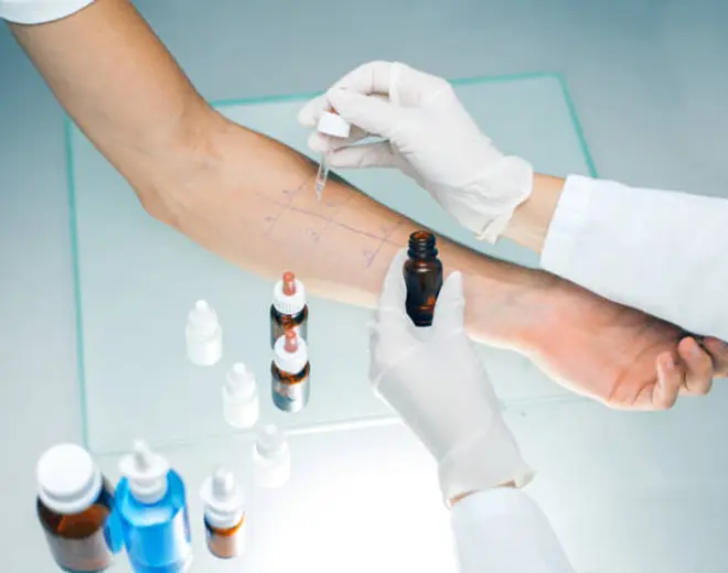 Best Skin Allergy Treatment in Indore - Aayam Skin Clinic